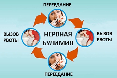 Лечение булимии в Новой Усмани